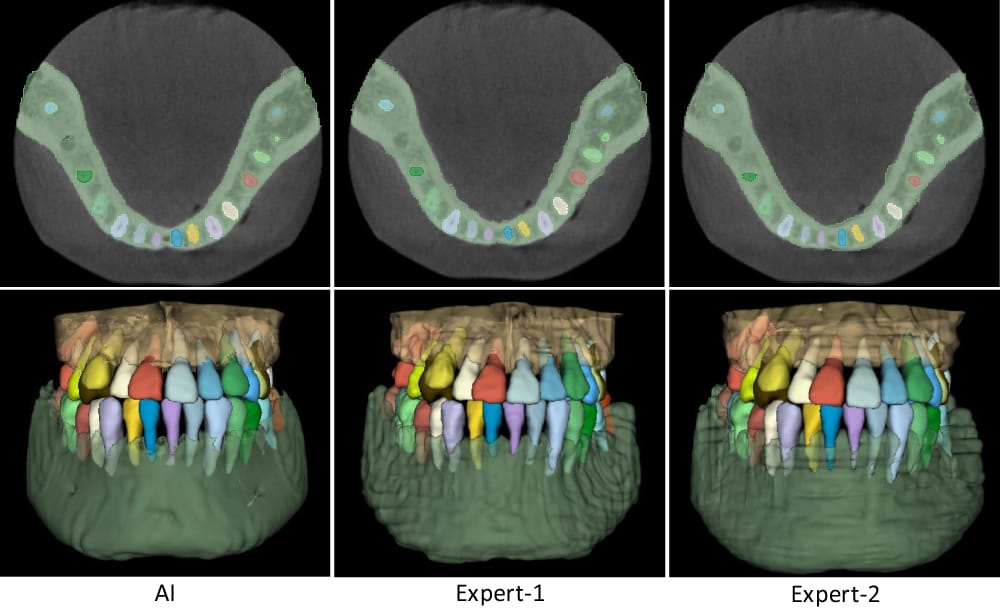 Segmentación anatómica IA CBCT