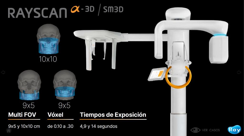 Rayscan Alpha 3D CBCT