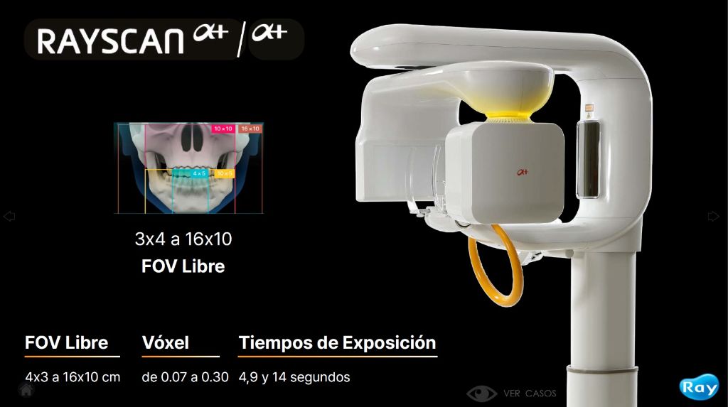 Rayscan Alpha Plus 160 5D CBCT