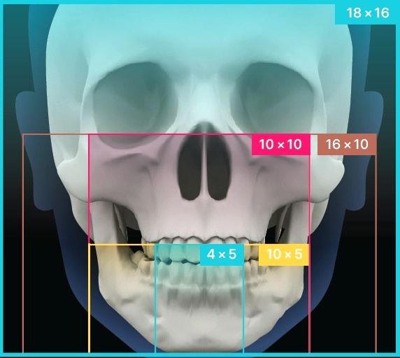 FOV dinámico Alpha+ 160