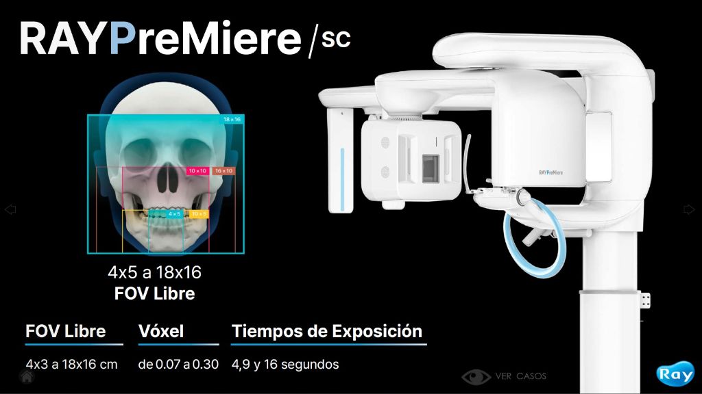 Rayscan Premiere 5D CBCT