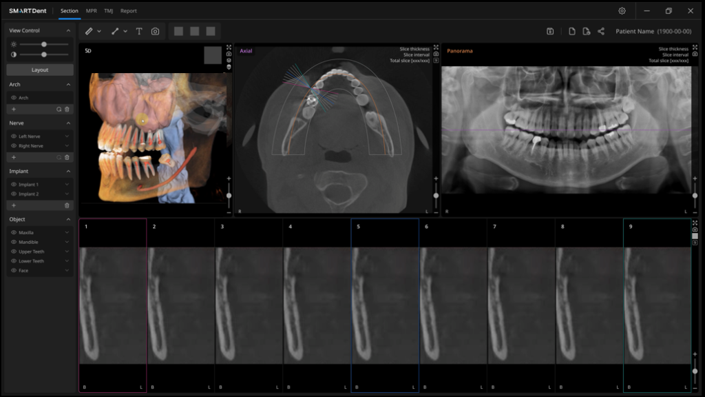 SMARTDent 5D Software planificación